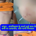भांडुप में अंधविश्वास के नाम पर बच्चे पर अत्याचार
