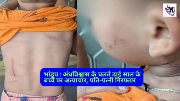 भांडुप में अंधविश्वास के नाम पर बच्चे पर अत्याचार